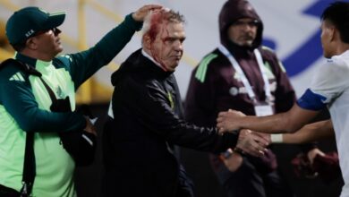 Mexico coach Javier Aguirre's head bleeds